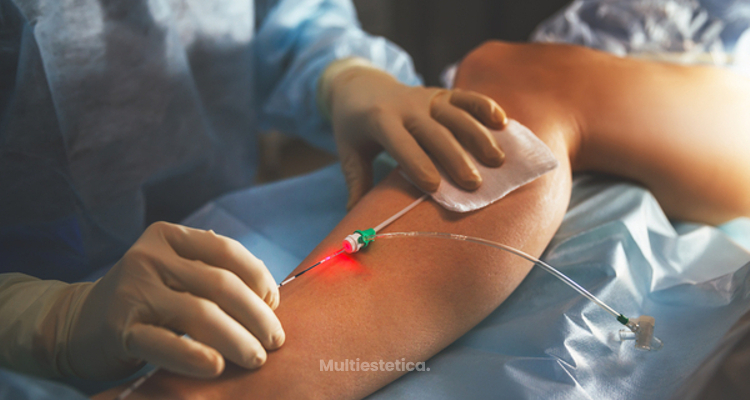 Dolor vascular en mano derecha