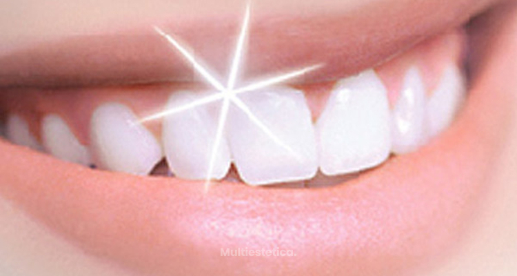 dientes blancos remedios caseros